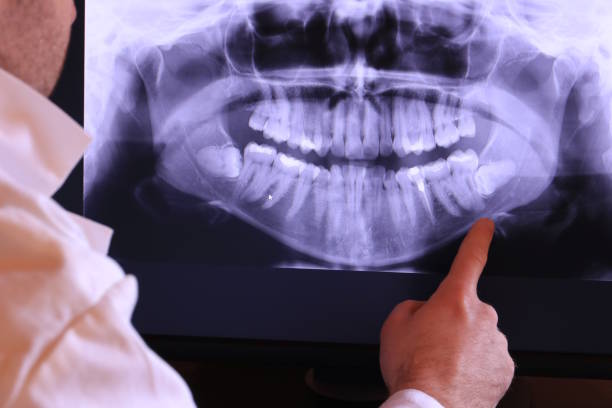 Best Emergency Tooth Extraction in Meeker, OK
