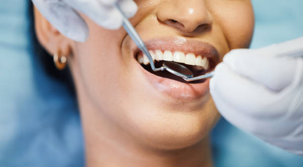 Best Emergency Wisdom Teeth Removal in Meeker, OK