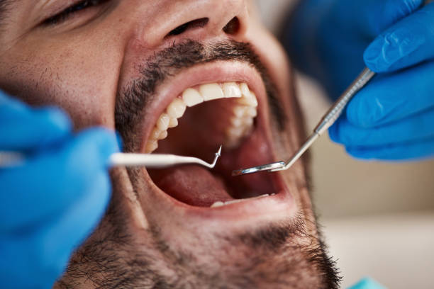 Best Emergency Broken Tooth Repair in Meeker, OK